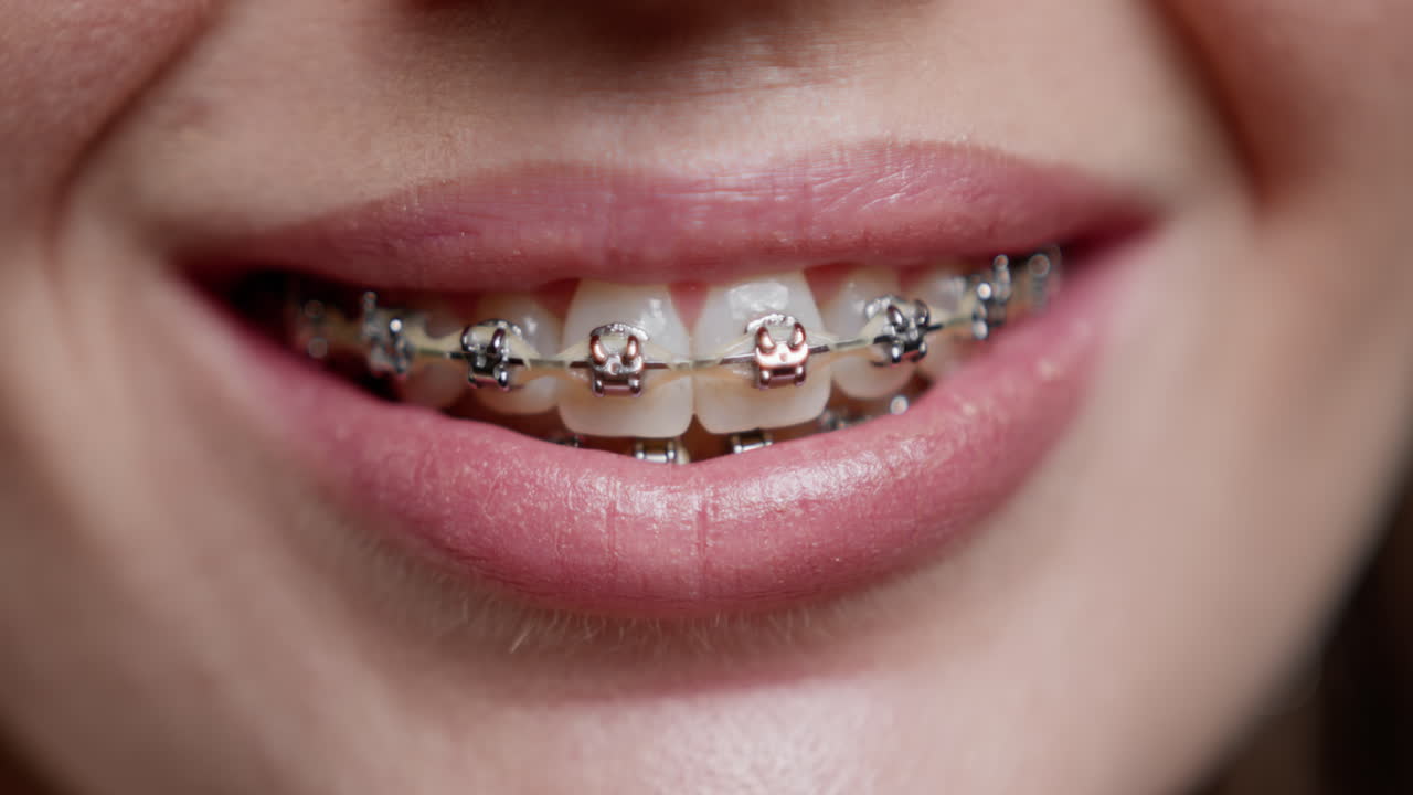 Woman with Metal Braces