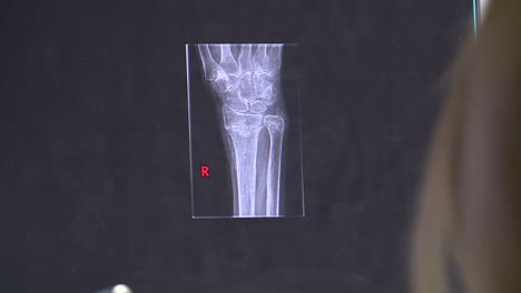 x-ray of wrist