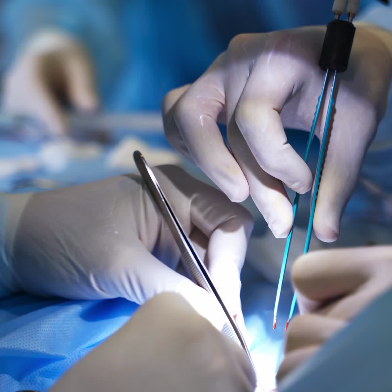 Diverse tools for operational intervention in doctor's hands. Surgeons using forceps in their work. Close up. Blurred backdrop
