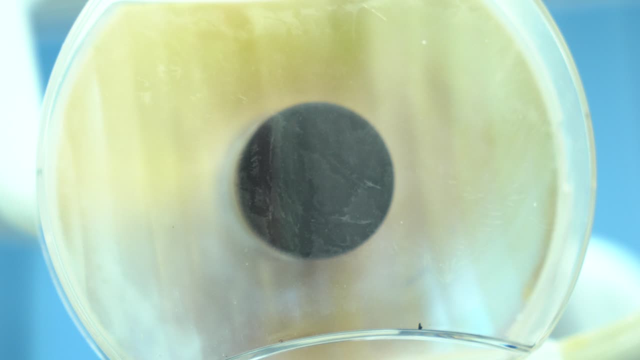 치과 조명 장치