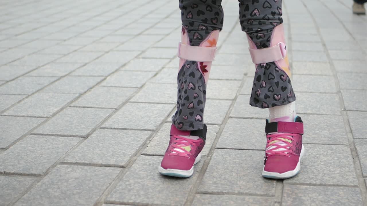 niño con aparatos ortopédicos para las piernas