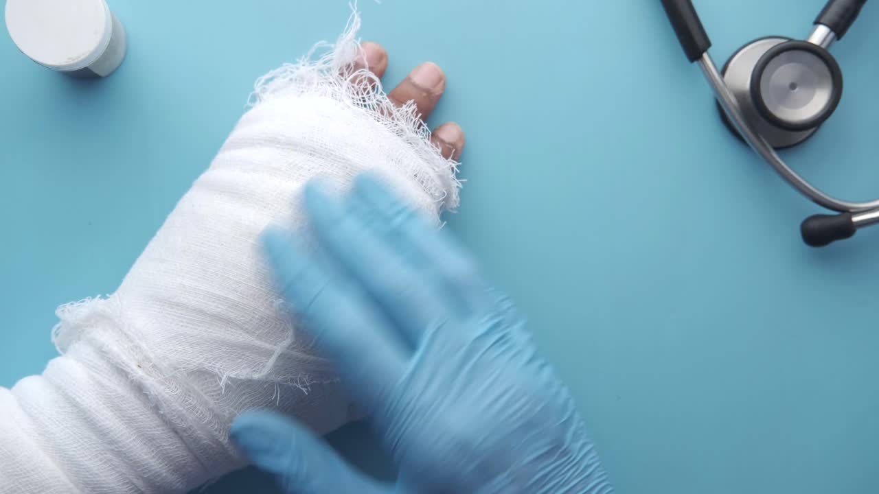 la mano lesionada está siendo examinada por un profesional médico