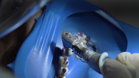 pulir los dientes durante la higiene dental usando pasta y pulidor eléctrico