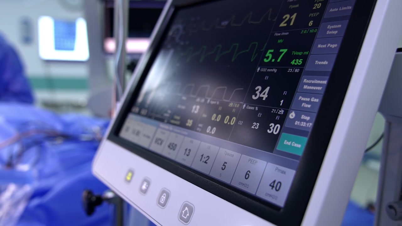 Monitor del moderno ventilatore polmonare. L'apparecchiatura mostra i segni vitali del paziente sotto intervento chirurgico. Primo piano. Sfondo sfocato.