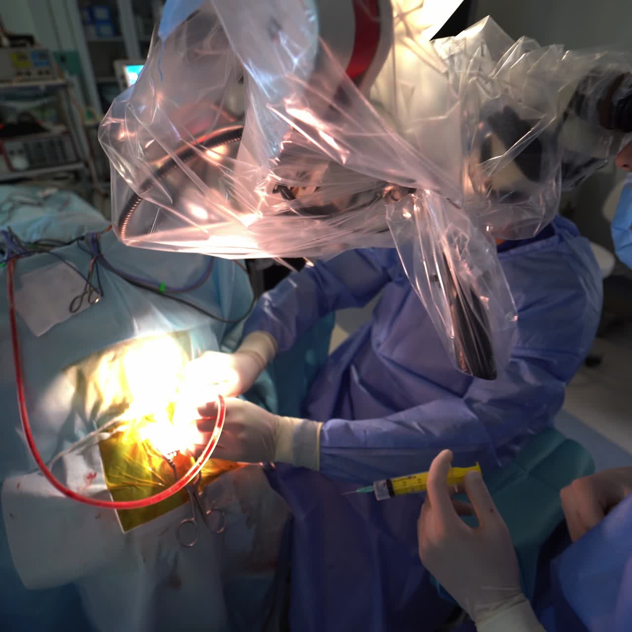 Surgeons apply medical instruments and devices during the operation. Equipped modern surgery room in hospital. Close up with gradual distancing