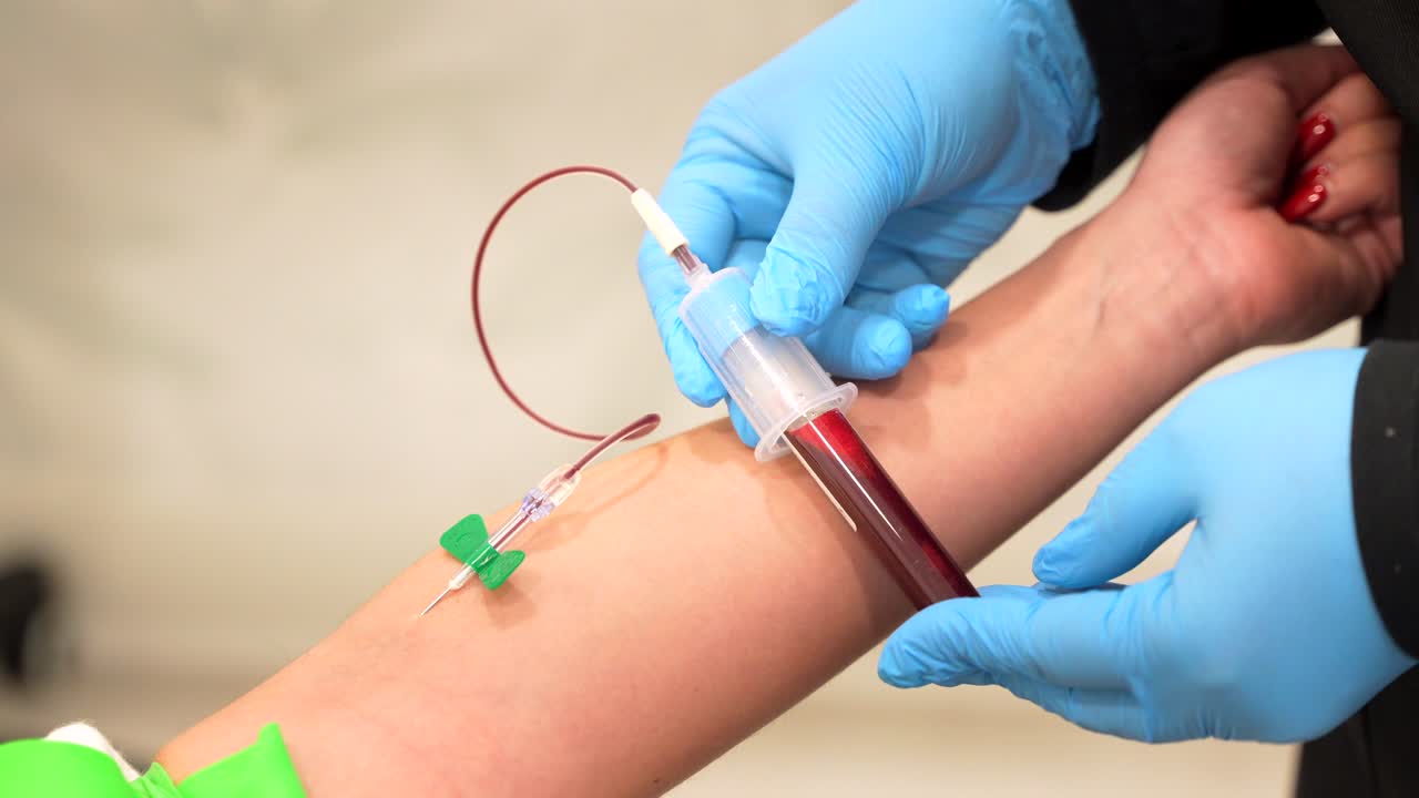 procedimiento de extracción de sangre