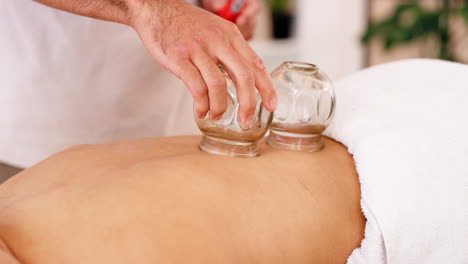 spa, bienestar y ventosas con la espalda de la mujer