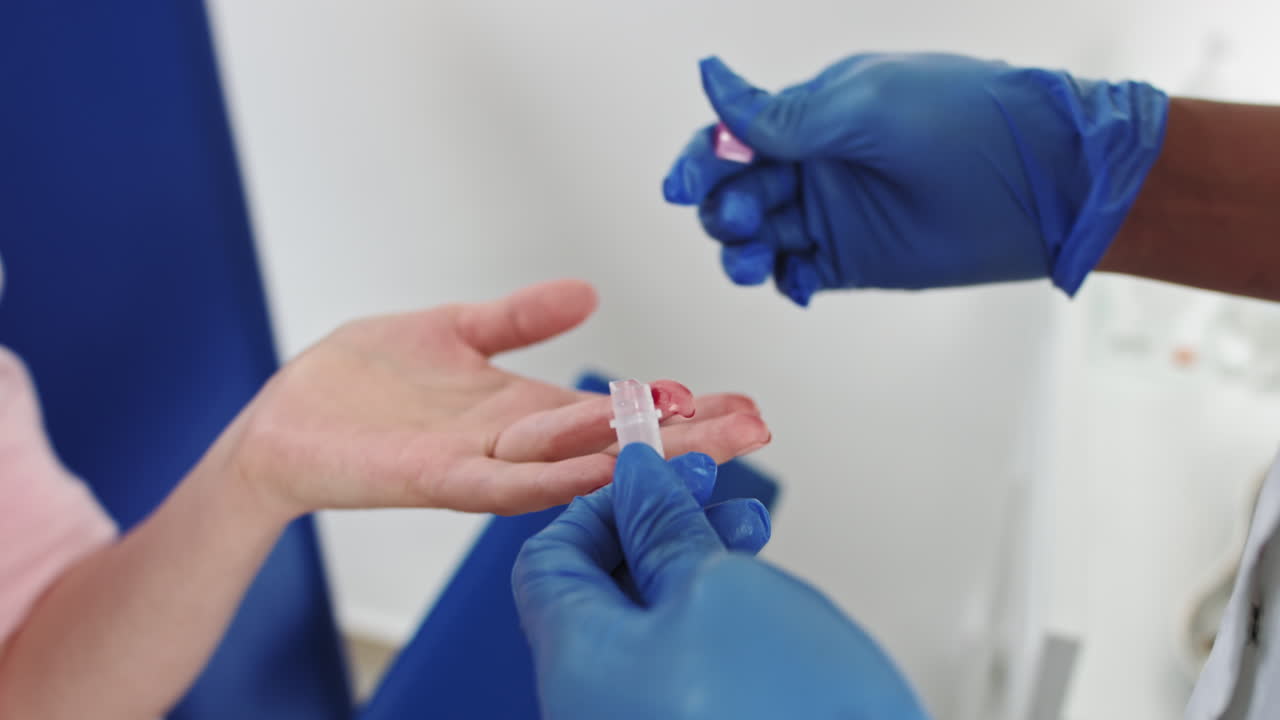 Primo piano di un prelievo di sangue dal dito con mani guantate; primo piano di un infermiere che esegue un esame del sangue