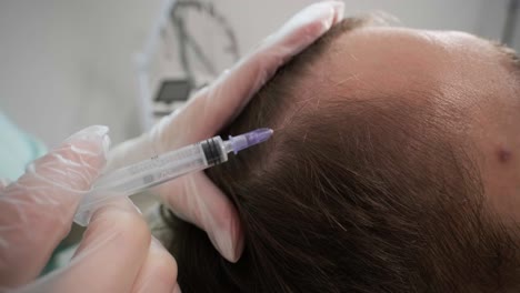 hair mesotherapy procedure in the modern cosmetology clinic