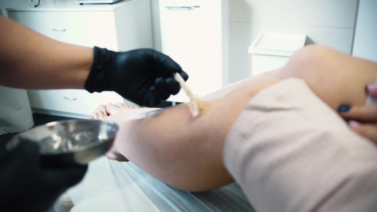 tratamiento de depilación de las piernas