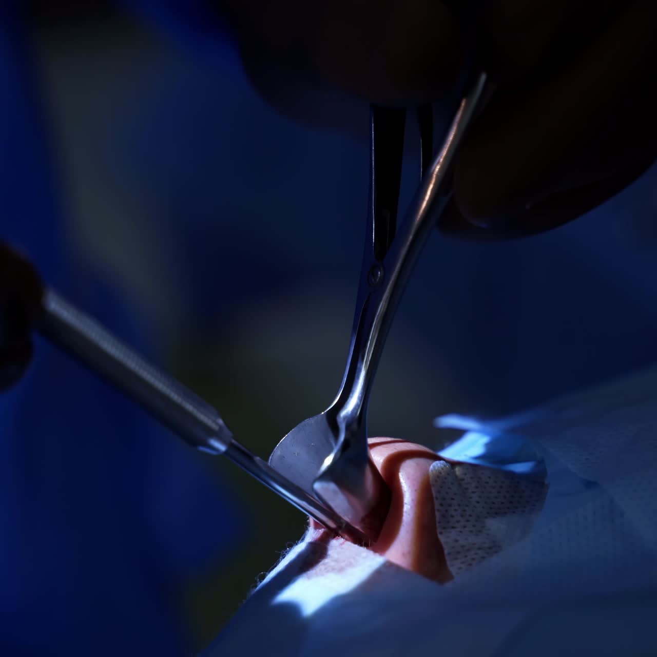 Hands of the surgeon close-up of the operating patient. Modern equipment in operating room