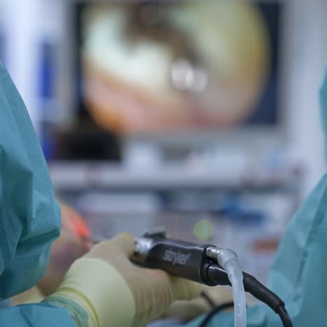 laparoscopic surgical operation in hospital