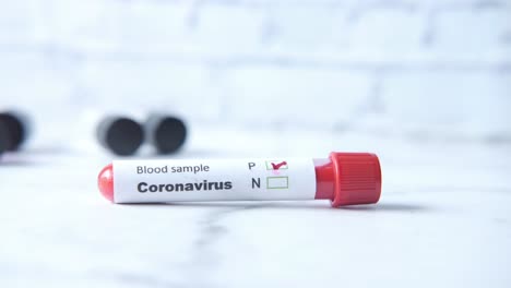 coronavirus blood sample test