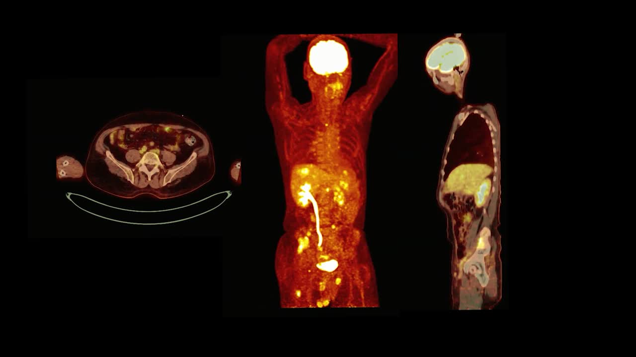 colección de ct de mascotas (tomografía por emisión de positrones) de todo el cuerpo humano renderización 3d i.