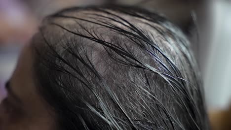 aceite masajeado en la cabeza que muestra signos de pérdida de cabello