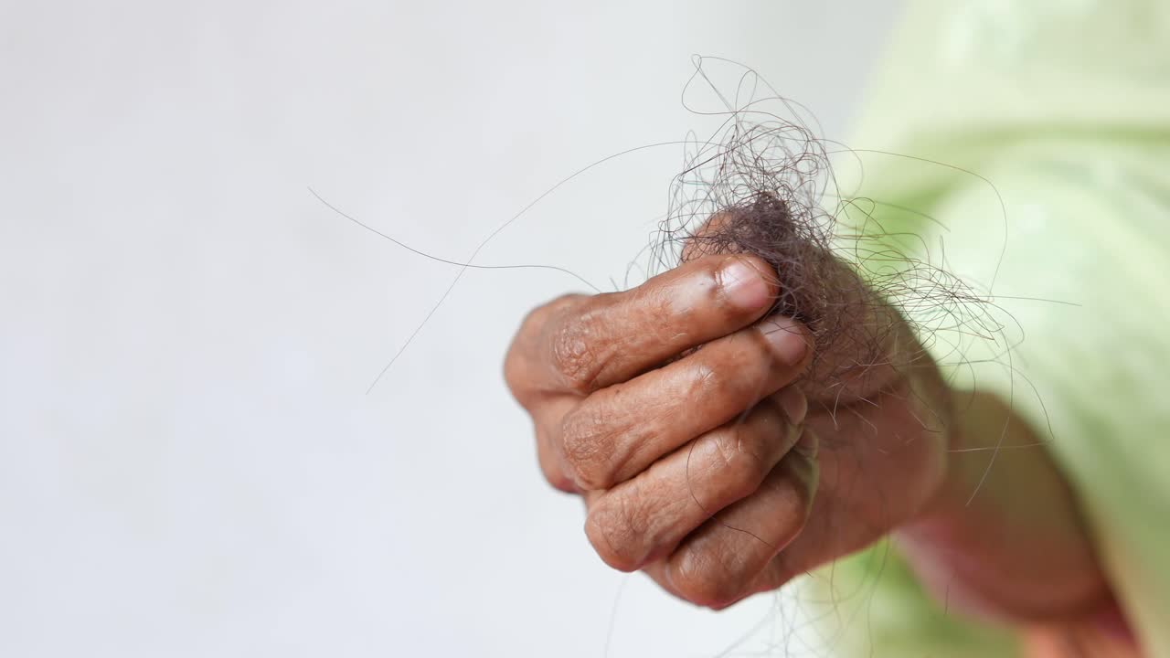 노인에서 머리카락이 빠지는 경우
