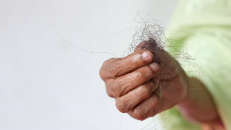 hair loss in elderly person