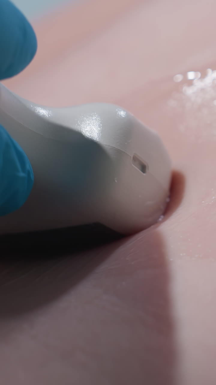 Medical imaging device in action, Hand holding ultrasound wand during clinical diagnostic procedure, Close examination involving ultrasound transducer and skin in medical environment