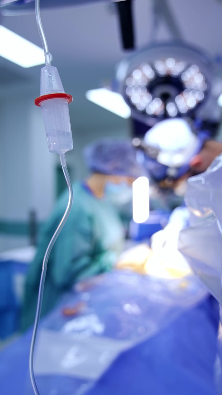 Soluzione fisiologica che gocciola nella flebo. Contagocce appeso nella sala operatoria. Operazione sfocata sullo sfondo. Video verticale