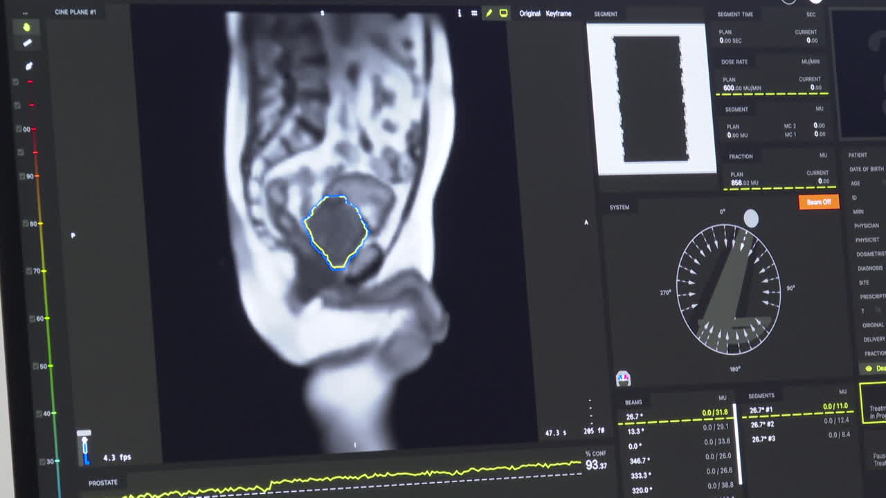 Medical Imaging of Pelvic Region for Treatment Planning