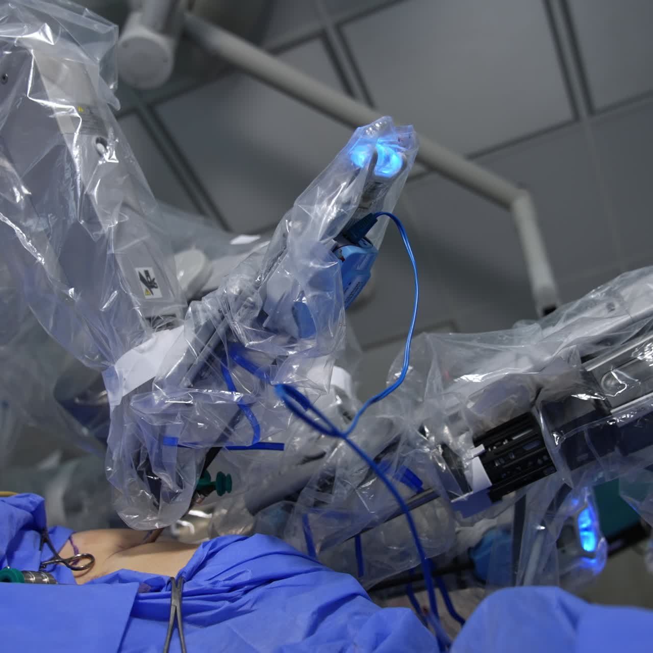 Da Vinci surgeon operating the patient. Robotic arms move in the patient's body through the little holes. Low angle view