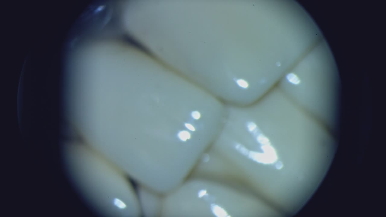 Teeth under the microscope. View from microscope on problem parts of every tooth. Close-up.