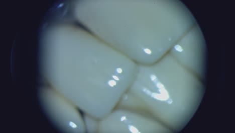 teeth under the microscope. view from microscope on problem parts of every tooth. close-up.