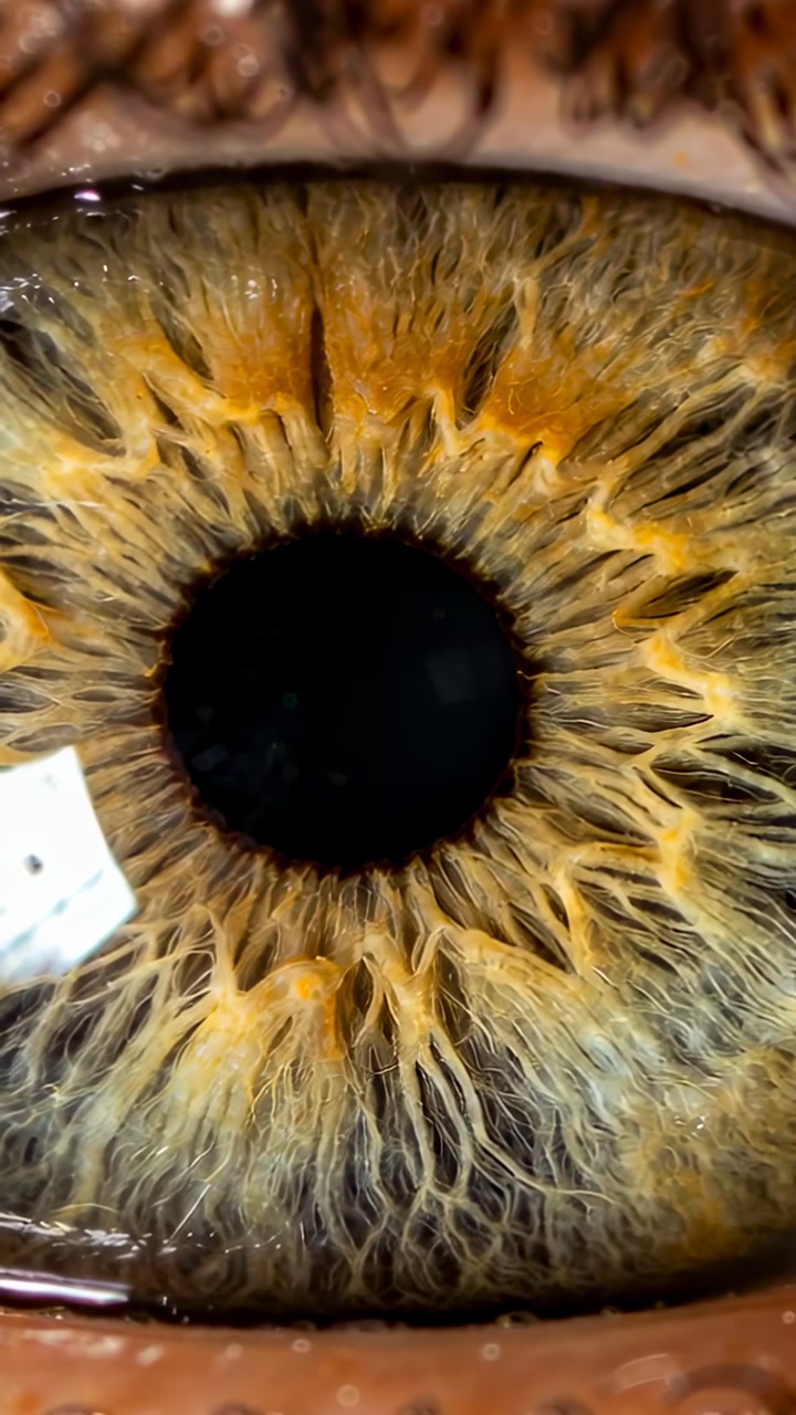 Vertical video: Recording macro eye showing pupil changes and brown iris in clinic, LED reflection
