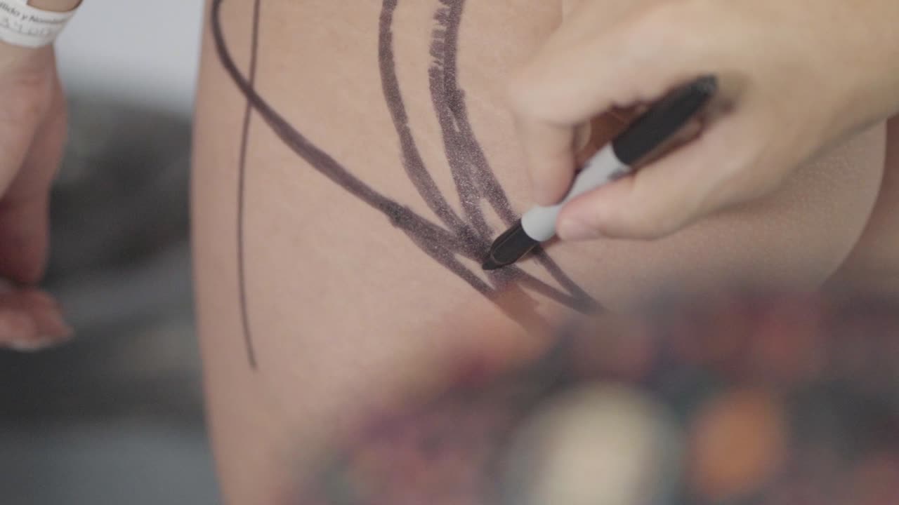 cirujano plástico marcando delicadamente las nalgas antes de la cirugía