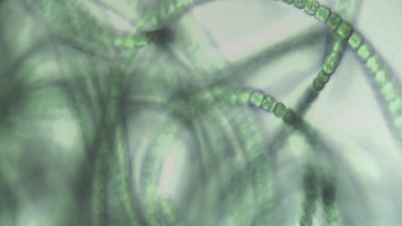 녹색 구슬 목걸이 같은 조류의 현미경 보기