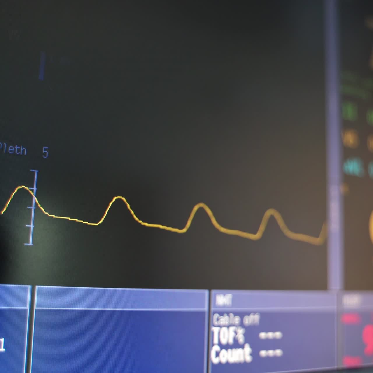 Heart cardiogram and numbers on screen. Yellow line moves at certain heart rate on black screen. Motion of wavy line of cardiogram on monitor. Close-up