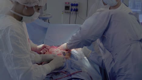Cardiosurgeons-perform-a-cut-with-the-help-of-a-coagulator-Aorto-coronary-bypass-surgery