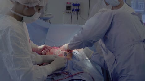 cardiosurgeons perform a cut with the help of a coagulator aorto-coronary bypass surgery