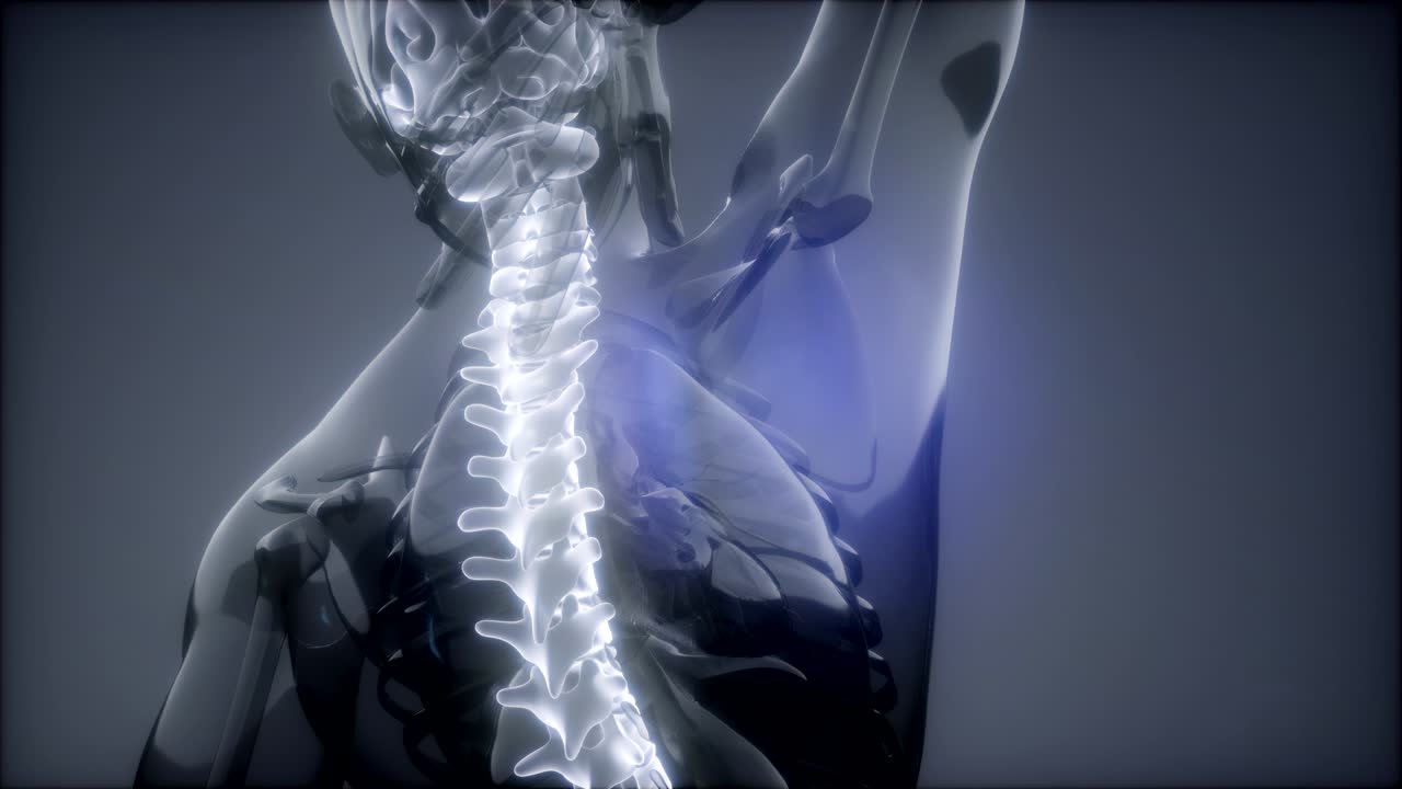 dolor de espalda en los huesos de la espalda