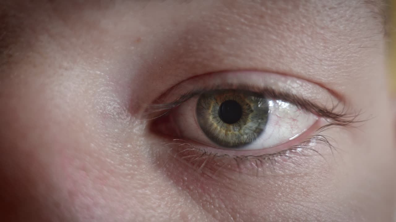 초록색 눈은  ⁇  놀랐습니다. 근접 촬영