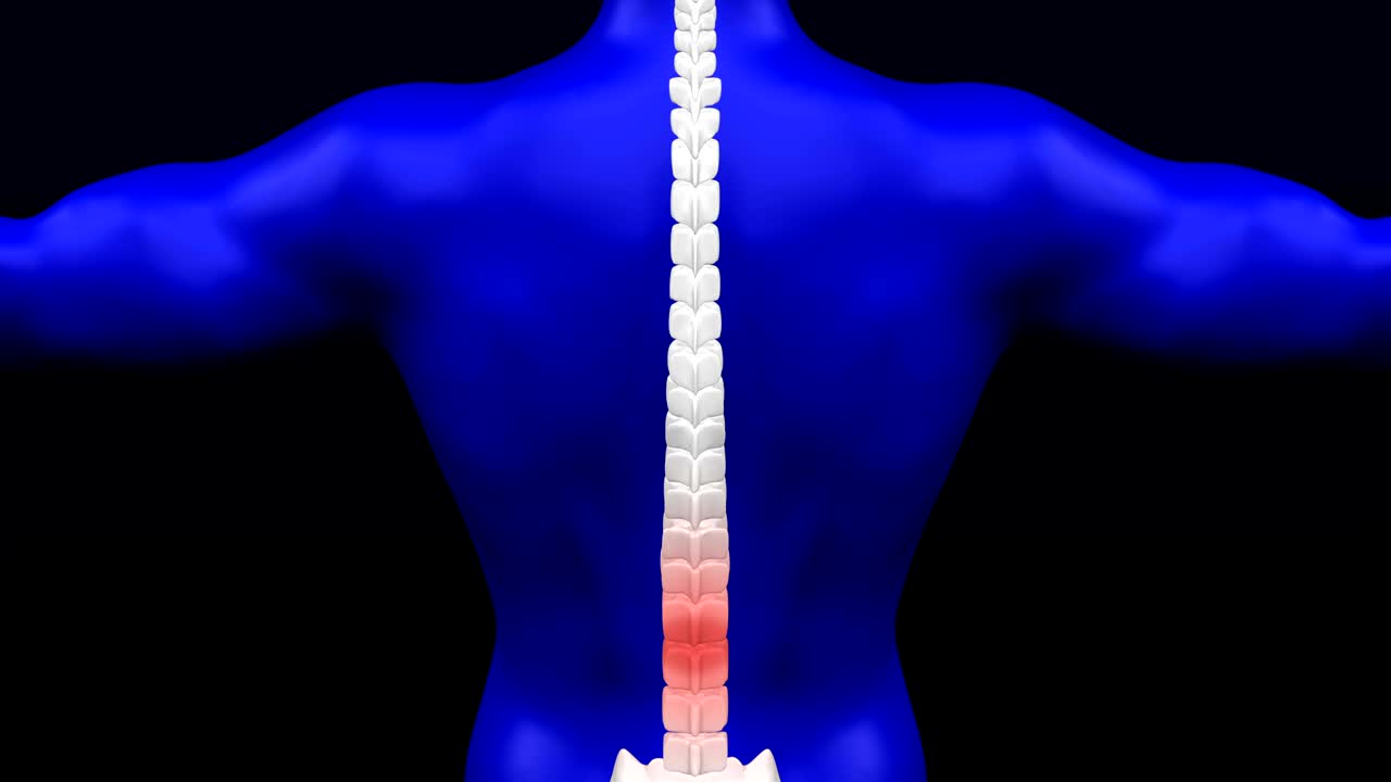 dolor en la parte baja de la espalda.