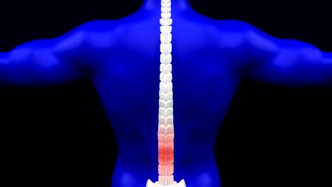 lower back pain.