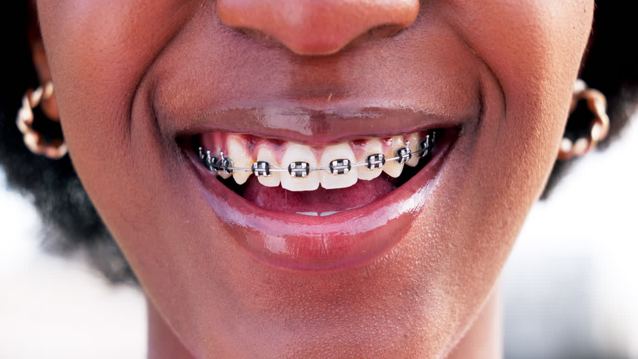 Teen, girl and mouth, teeth