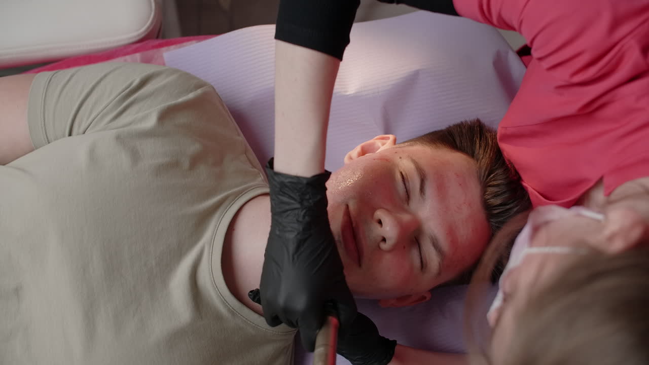 Facial Laser Treatment