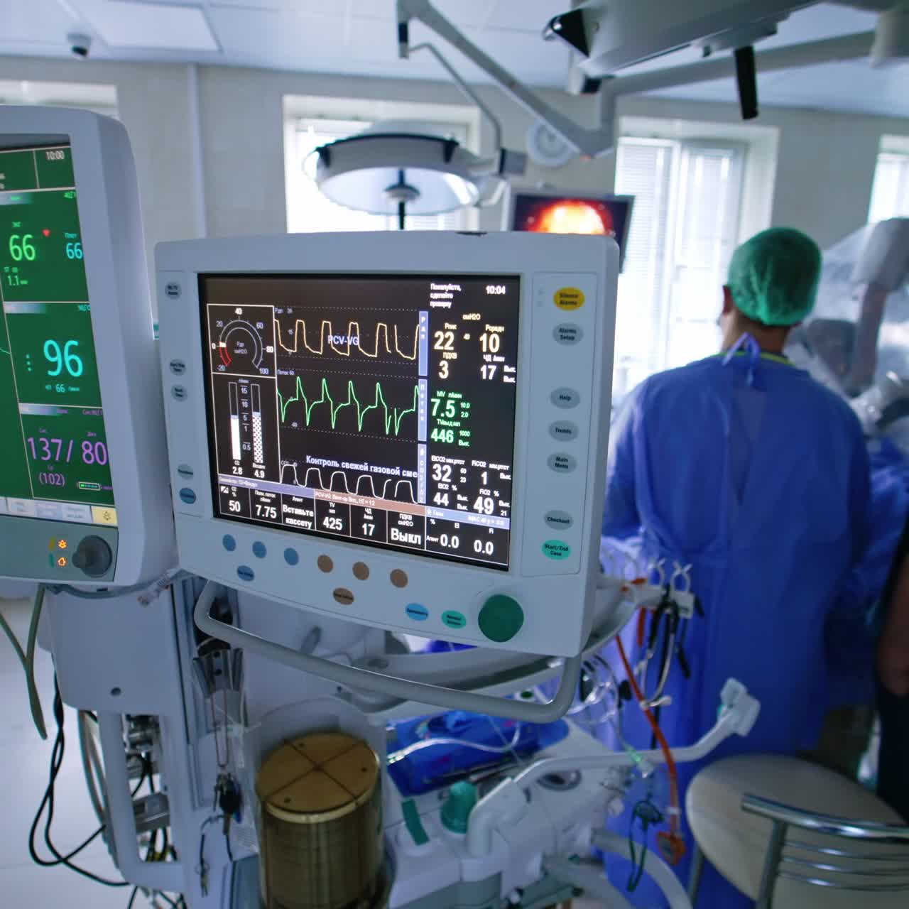Segni vitali del paziente operato sui monitor del ventilatore polmonare. Due medici davanti al robot Da Vinci ne osservano il lavoro sullo schermo