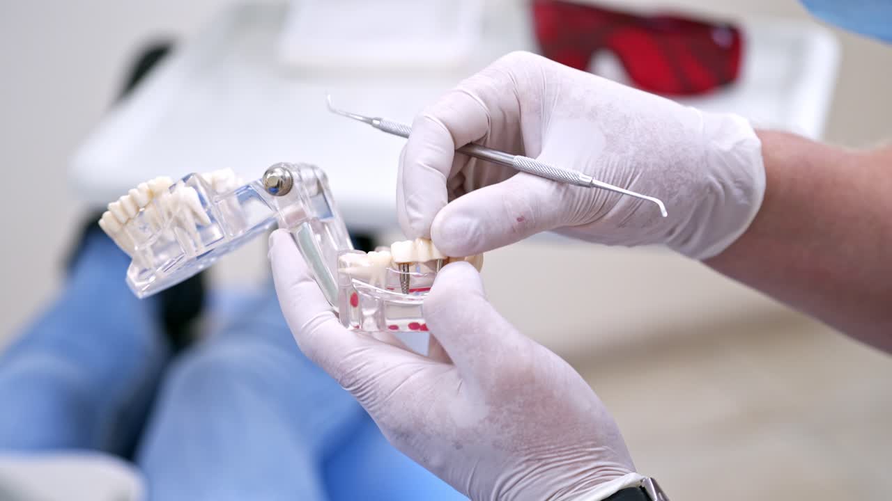 Doctor holding teeth jaw model. Teeth model holding by doctor in dentistry clinic