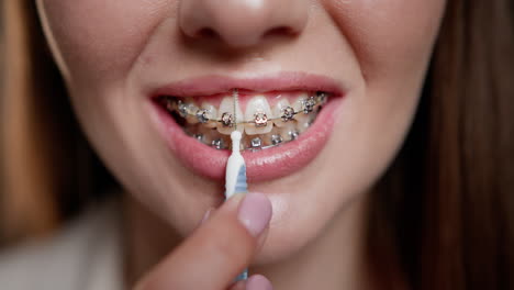 mujer limpiando los dientes con aparatos ortopédicos usando un cepillo interdental