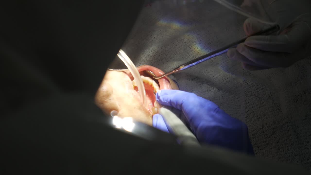 Professional dentist treatment and cleaning teeth from plaque or procedures of dental.