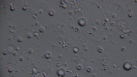 microscopic view of spermatozoa, showing numerous round cells and a few with visible tails, moving in a fluid medium under magnification