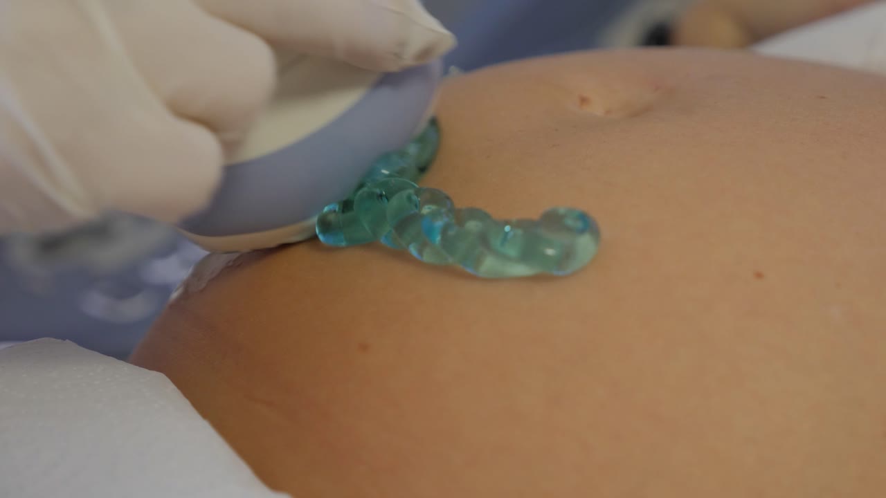 초음파 임신 변환기 블루 젤 임신 배 초음파 스캐너 근접 전도성 젤 5d 초음파