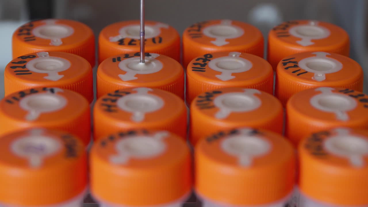 primer plano en el laboratorio médico proceso automatizado de detección de células cancerosas en pacientes con cáncer