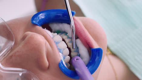 Woman undergoing professional teeth whitening procedure at dental clinic, close up