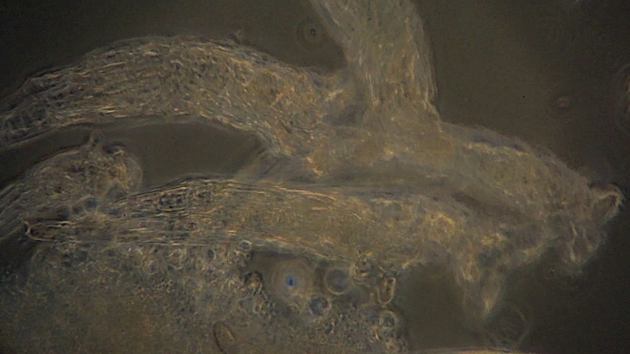 микроскопические коловратки используют реснички для фильтрации корма, как видно в фазово-контрастном микроскопе