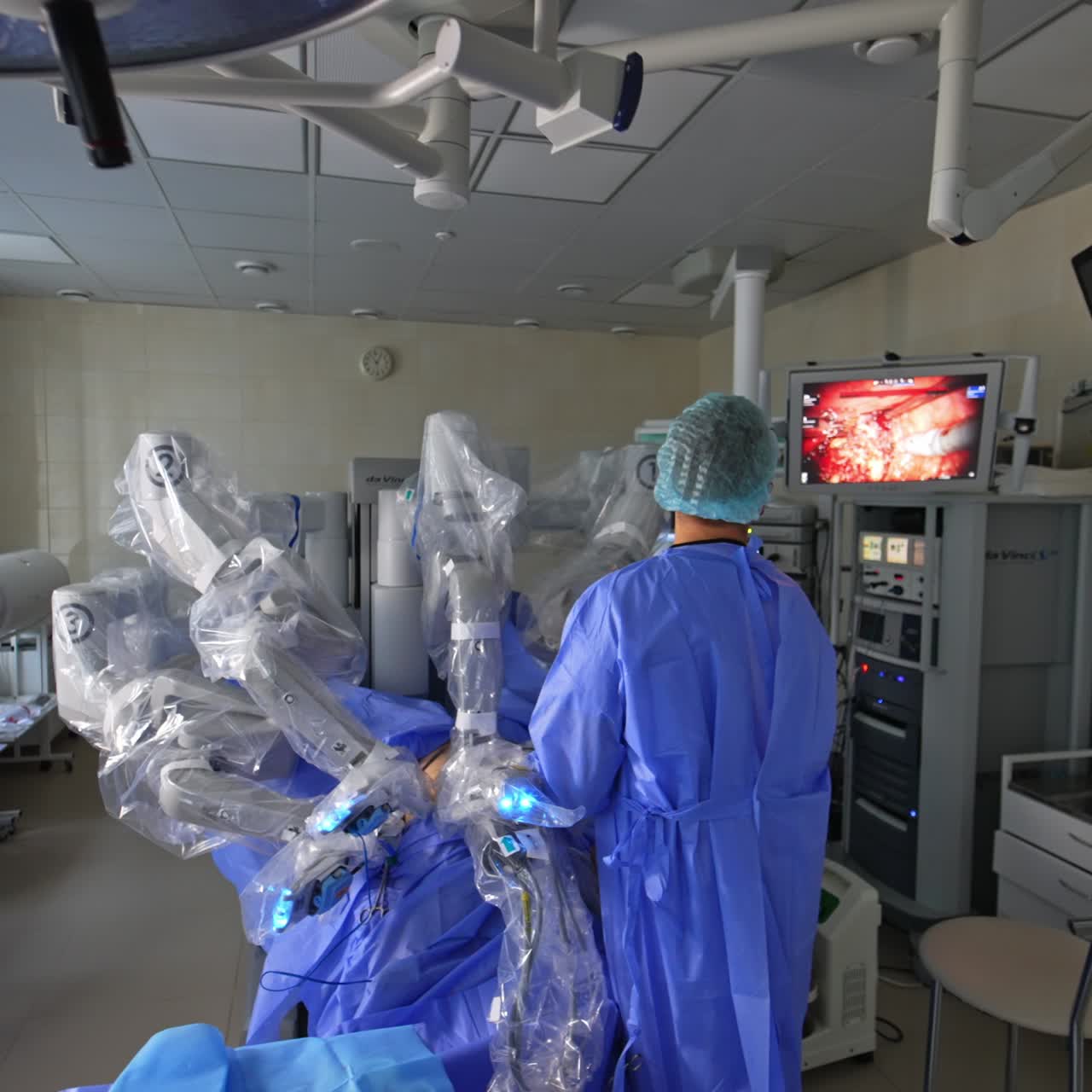 Male doctor stands near Da Vinci robot his back to camera. Focused medic looks at the screen with procedure in progress. View from top