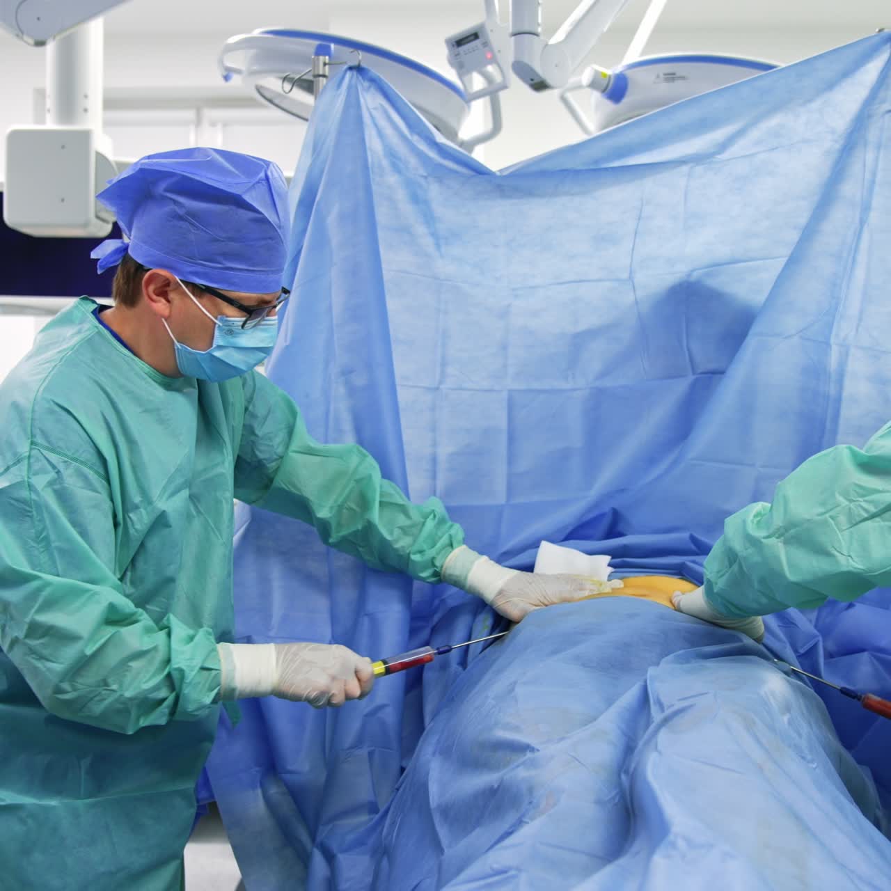 Professional surgeons perform stem cell operation in modern surgery room. Female assistant helping the doctors